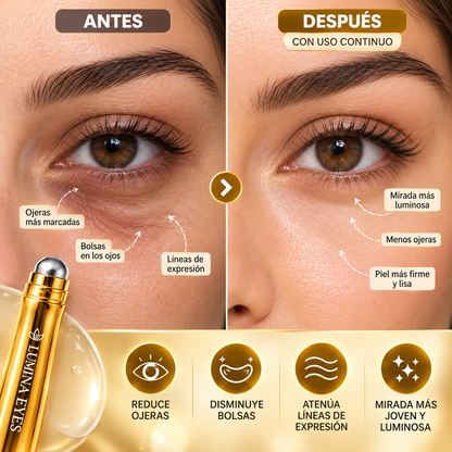 LUMINA EYES Elimina bolsas y lineas de expresión