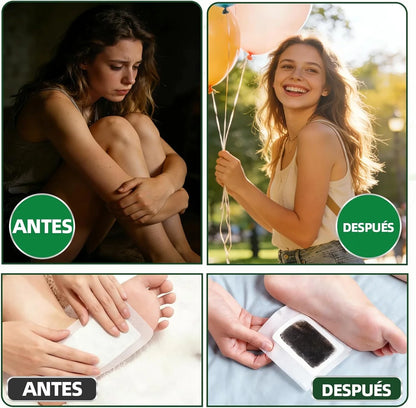 Parches Desintoxicantes Naturales 30 Unid .- Kinoki Detox™